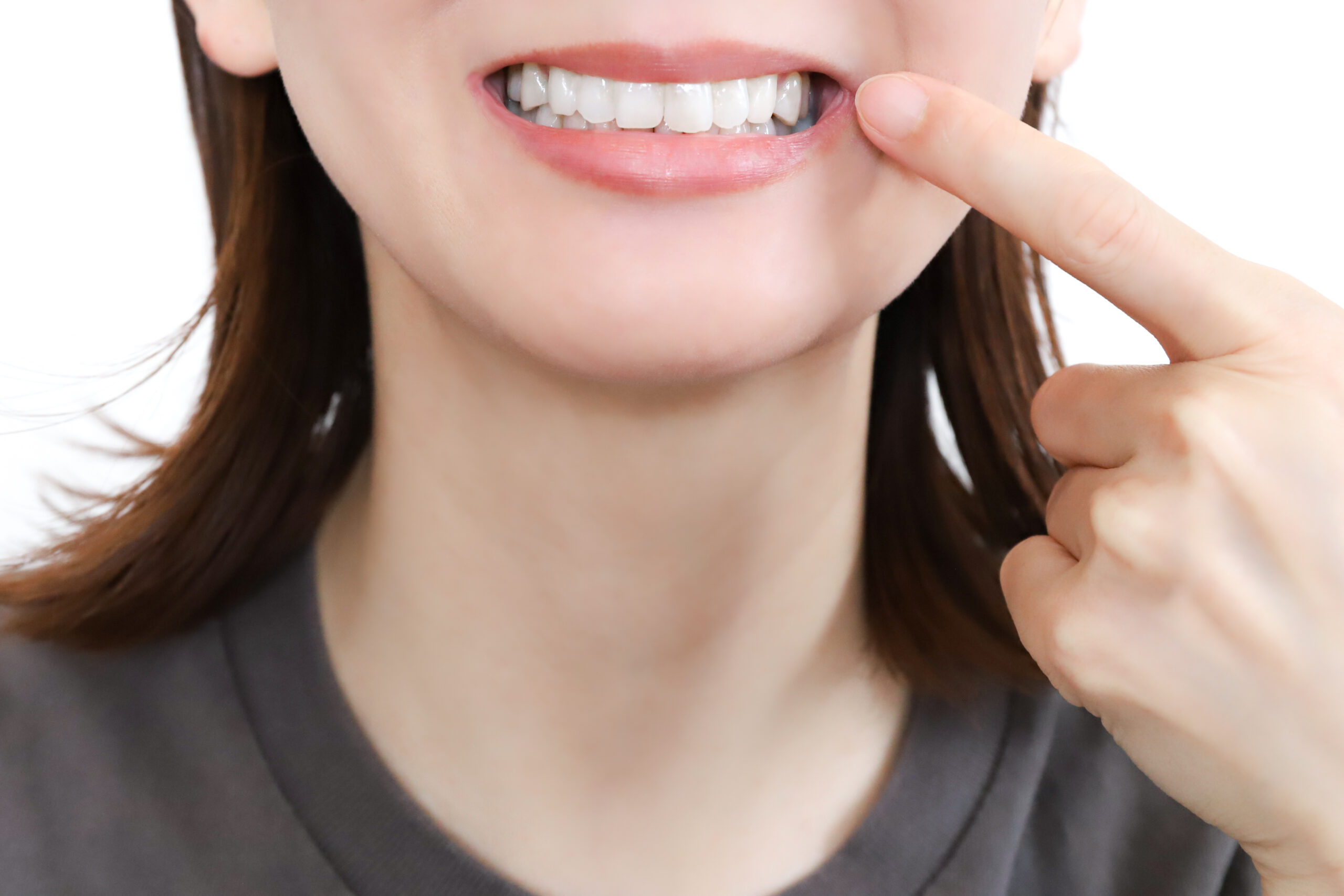 ホワイトニング治療